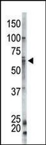 Ubiquilin 1 Antibody in Western Blot (WB)