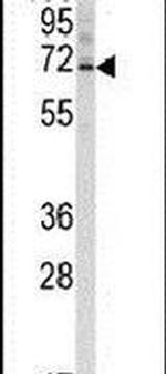 Ubiquilin 3 Antibody in Western Blot (WB)