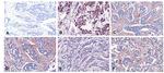 Urokinase Antibody in Immunohistochemistry (IHC)