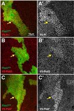 V5 Tag Antibody in Immunohistochemistry (IHC)
