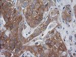 VASP Antibody in Immunohistochemistry (Paraffin) (IHC (P))