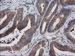 VASP Antibody in Immunohistochemistry (Paraffin) (IHC (P))