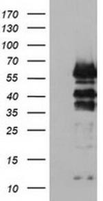 VASP Antibody in Western Blot (WB)