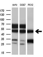VAT1L Antibody in Western Blot (WB)