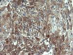VBP1 Antibody in Immunohistochemistry (Paraffin) (IHC (P))