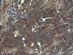 VBP1 Antibody in Immunohistochemistry (Paraffin) (IHC (P))