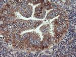 VBP1 Antibody in Immunohistochemistry (Paraffin) (IHC (P))