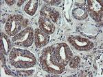 VBP1 Antibody in Immunohistochemistry (Paraffin) (IHC (P))
