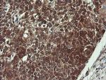 VBP1 Antibody in Immunohistochemistry (Paraffin) (IHC (P))