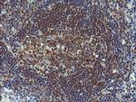 VBP1 Antibody in Immunohistochemistry (Paraffin) (IHC (P))