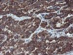 VBP1 Antibody in Immunohistochemistry (Paraffin) (IHC (P))