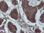VBP1 Antibody in Immunohistochemistry (Paraffin) (IHC (P))