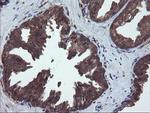 VBP1 Antibody in Immunohistochemistry (Paraffin) (IHC (P))