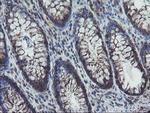 VBP1 Antibody in Immunohistochemistry (Paraffin) (IHC (P))