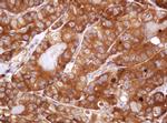 VBP1 Antibody in Immunohistochemistry (Paraffin) (IHC (P))