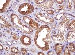 VBP1 Antibody in Immunohistochemistry (Paraffin) (IHC (P))