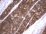 VBP1 Antibody in Immunohistochemistry (Paraffin) (IHC (P))