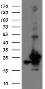 VBP1 Antibody in Western Blot (WB)