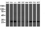 VBP1 Antibody in Western Blot (WB)