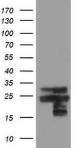 VBP1 Antibody in Western Blot (WB)