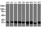 VBP1 Antibody in Western Blot (WB)