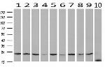 VBP1 Antibody in Western Blot (WB)