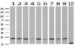 VBP1 Antibody in Western Blot (WB)