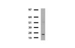 VBP1 Antibody in Western Blot (WB)