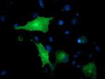 VCAM1 Antibody in Immunocytochemistry (ICC/IF)