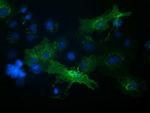 VCAM1 Antibody in Immunocytochemistry (ICC/IF)