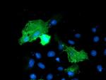 VCAM1 Antibody in Immunocytochemistry (ICC/IF)