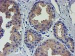 VCAM1 Antibody in Immunohistochemistry (Paraffin) (IHC (P))