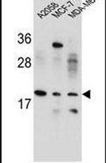VCX Antibody in Western Blot (WB)