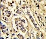 VEGF Receptor 2 Antibody in Immunohistochemistry (IHC)