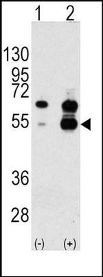 VEGF Antibody in Western Blot (WB)