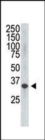 VEGFD Antibody in Western Blot (WB)