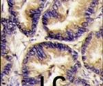 VEGFB Antibody in Immunohistochemistry (IHC)