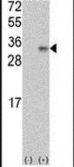VEGFB Antibody in Western Blot (WB)