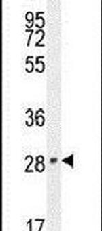 VGLL2 Antibody in Western Blot (WB)