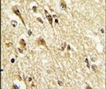 VGLUT2 Antibody in Immunohistochemistry (IHC)