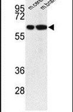 VGLUT2 Antibody in Western Blot (WB)