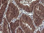 VHL Antibody in Immunohistochemistry (Paraffin) (IHC (P))