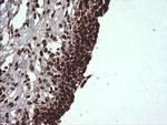 VHL Antibody in Immunohistochemistry (Paraffin) (IHC (P))