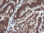 VHL Antibody in Immunohistochemistry (Paraffin) (IHC (P))