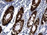 VIL1 Antibody in Immunohistochemistry (Paraffin) (IHC (P))