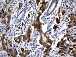 VIL1 Antibody in Immunohistochemistry (Paraffin) (IHC (P))