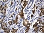VIL1 Antibody in Immunohistochemistry (Paraffin) (IHC (P))