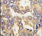 VSNL1 Antibody in Immunohistochemistry (IHC)