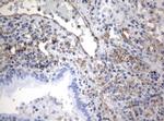VIM Antibody in Immunohistochemistry (Paraffin) (IHC (P))