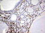 VIM Antibody in Immunohistochemistry (Paraffin) (IHC (P))